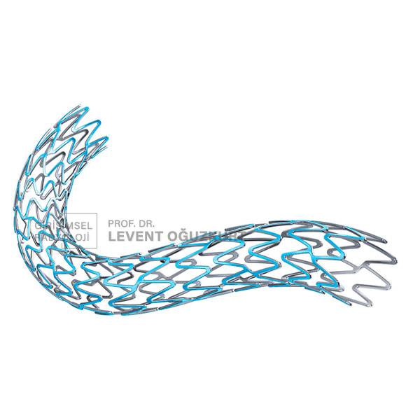 anjiyo ie stent tedavisi